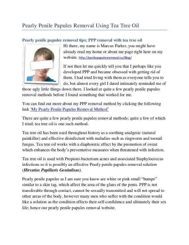 Pearly Penile Papules Tea Tree Oil Pearly Penile Papules Tea Tree Oil